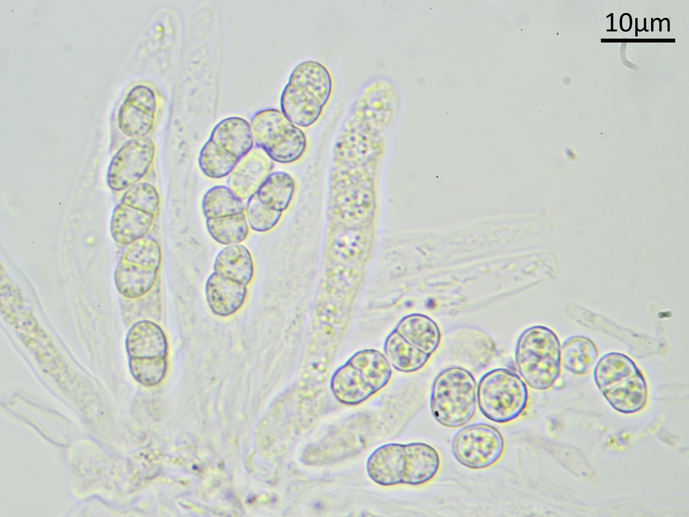 Xenonectriella zimmermannii (door Henk-Jan van der Kolk)