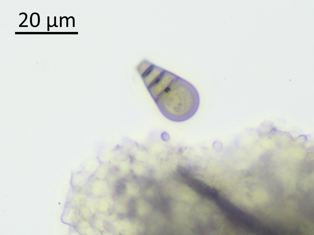 Endophragmiella boothii (door Henk-Jan van der Kolk)