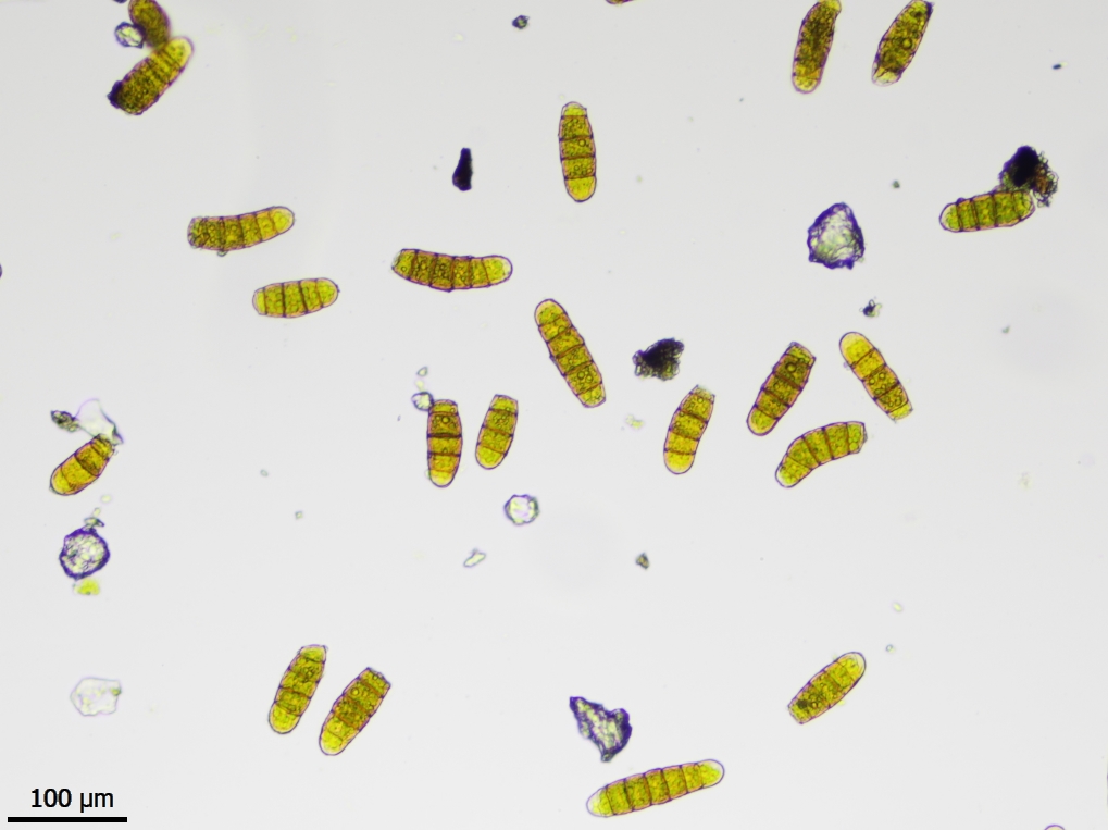 Orthotrichum tenellum (door Lukas Verboom)