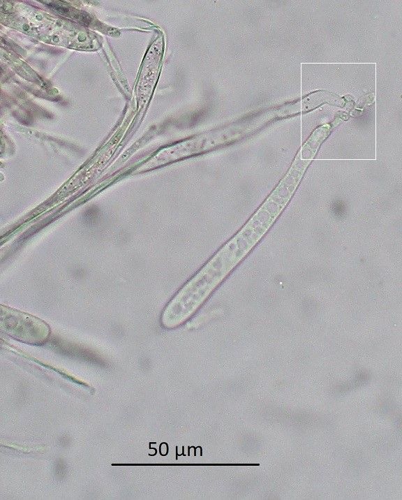 Rutstroemia fruticeti (door Laurens van der Linde)